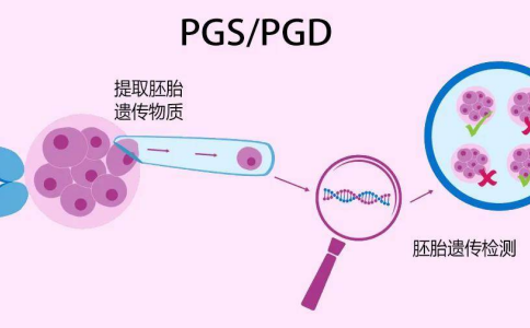 泰国和美国使用的是第三代试管婴儿技术