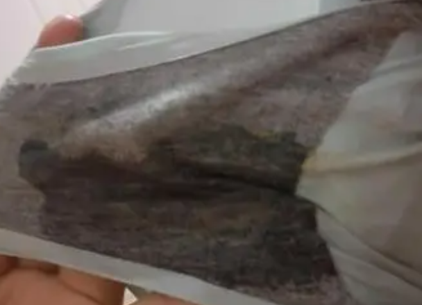 慢性漏羊水对胎儿有影响