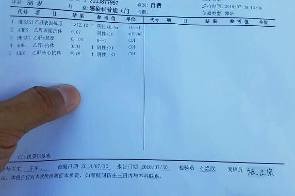 乙肝是一种传染性疾病
