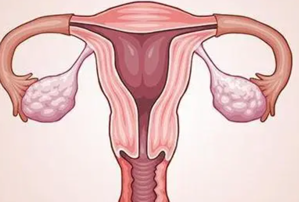 子宫内膜出血是多种原因引起的