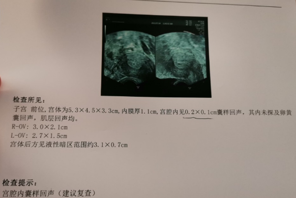 建卡时需要准备彩超检查结果