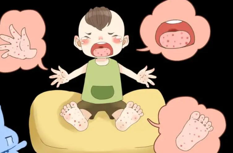 儿童患手足口病是什么样子，有具体的症状图片吗？
