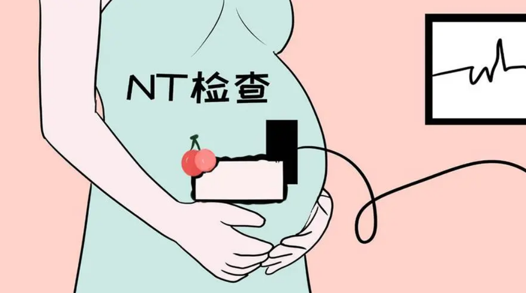 nt检查可筛查胎儿畸形
