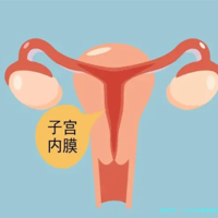 2025年多囊卵巢综合征：检查与试管婴儿的可能性（试管费用成功率）