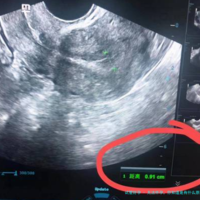 无法怀孕，你知道是有什么原因吗？为什么怀不上孕，我们有哪些应对措施？