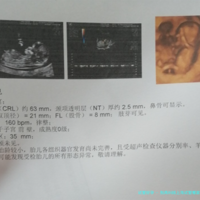别再纠结上海试管哪家医院好，最新成功率排名帮你选