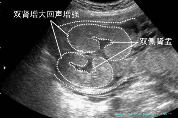 合肥三代试管男孩价格是多少(费用10万左右)