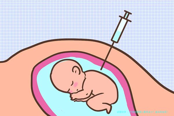 宁波试管婴儿费用多少？成功率如何？