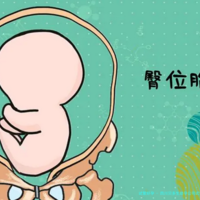 四川贝多生助孕公司试管婴儿服务费用全解析：近年数据与趋势分析