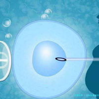 2026日本成功率试管婴儿机构哪家比较好(日本试管成功率有多大)