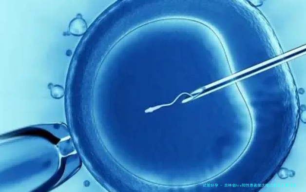 吉林省hiv阳性患者做洗精试管婴儿费用是多少？