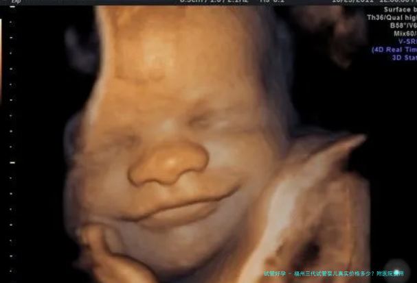 福州三代试管婴儿真实价格多少？附医院费用清单