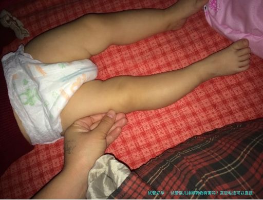 试管婴儿排卵药物有害吗？宫腔粘连可以直接做试管婴儿吗？