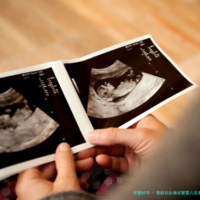 高龄妇女做试管婴儿还是自然怀孕好？胎儿会存在哪些区别