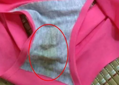 孕期内裤发黄和胎儿男女没关系