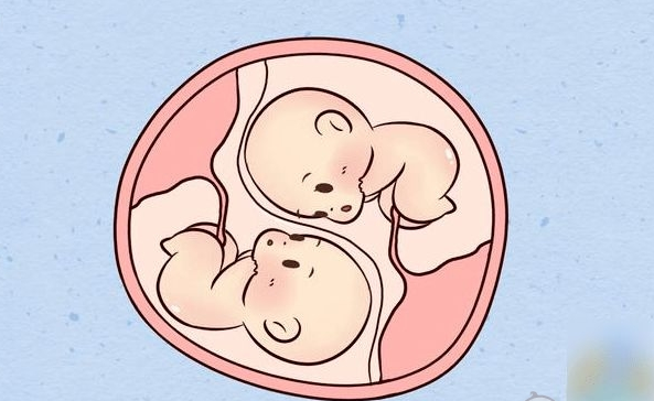 双生子价格比较贵