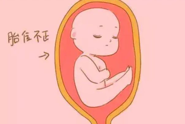 胎位不正又叫胎位异常