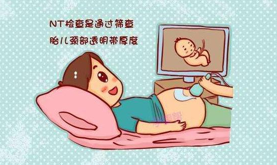 NT检查可以筛查胎儿畸形