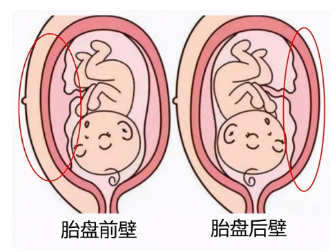 [子宫前壁是男是女，怀孕前壁和后壁看男女准吗？]