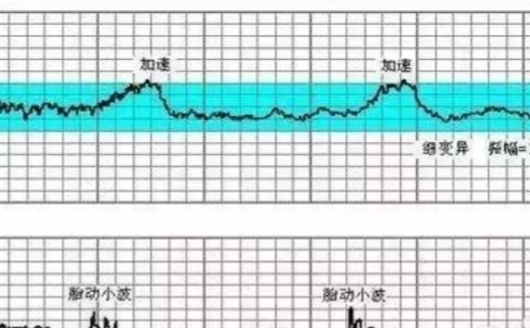 胎心监护能监测胎儿胎心率