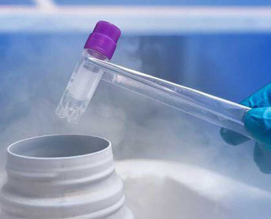 精子保存费用和地区有差异
