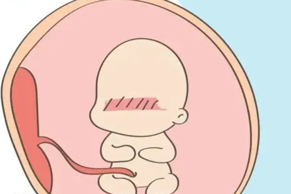 早孕反应可以判断男女
