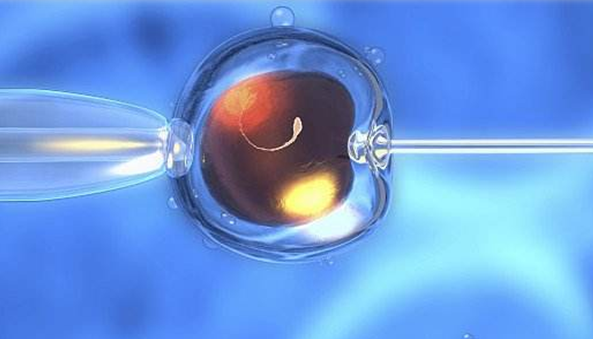 [柬埔寨试管婴儿自助攻略，从医院选择到移植也不难]