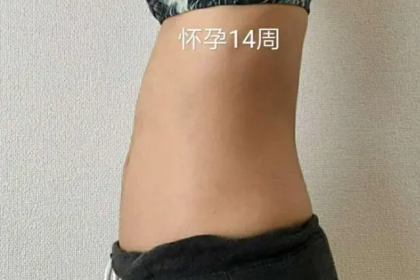 怀孕14周孕妇肚子不明显