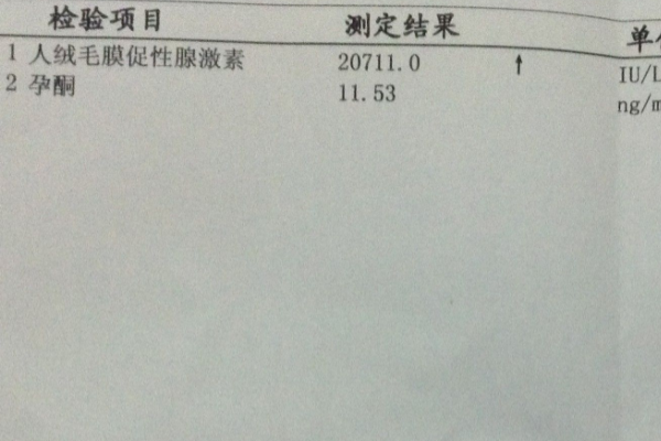孕酮低会导致成功率下降