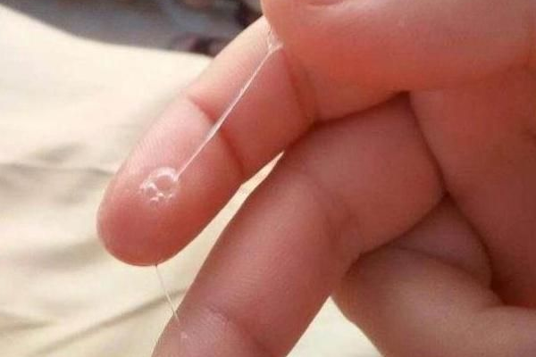 月经前一周白带增多是怀孕