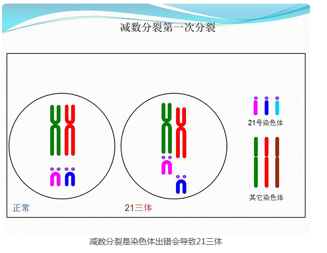 [21三体是精子还是卵子有问题]