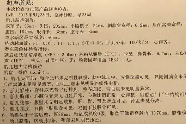 唐筛和四维是两种独立的检查