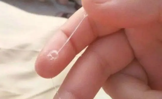排卵期宫颈会分泌粘液