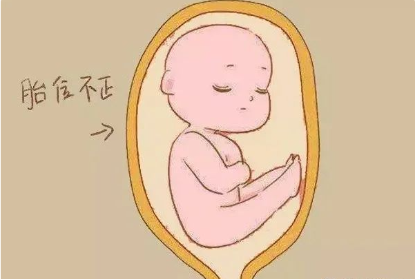 右枕前位就是胎位的一种