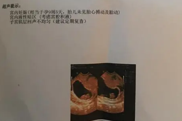 检查设备误差导致误诊成胎停