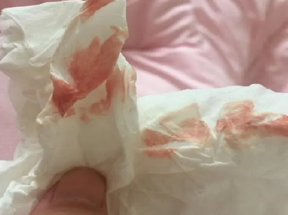 孕初期有淡粉色是正常情况
