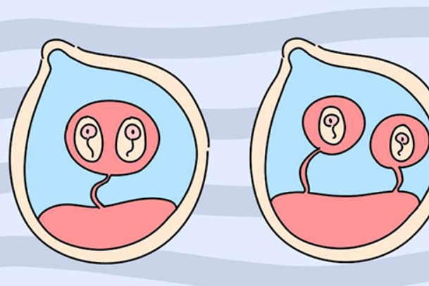 误诊胎停的原因有很多