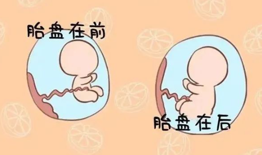 胎盘前壁和后壁都是正常的