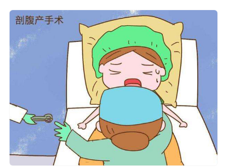 剖腹产后要注意修养