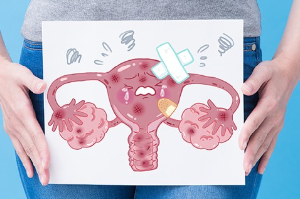 子宫腺肌症是常见妇科疾病