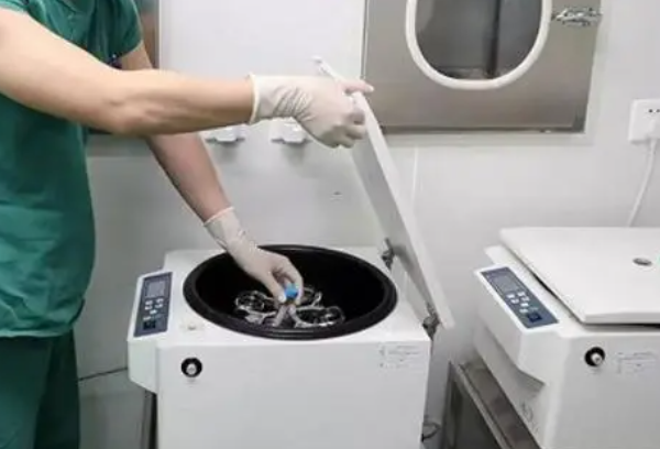常用的精子洗涤方法有三种