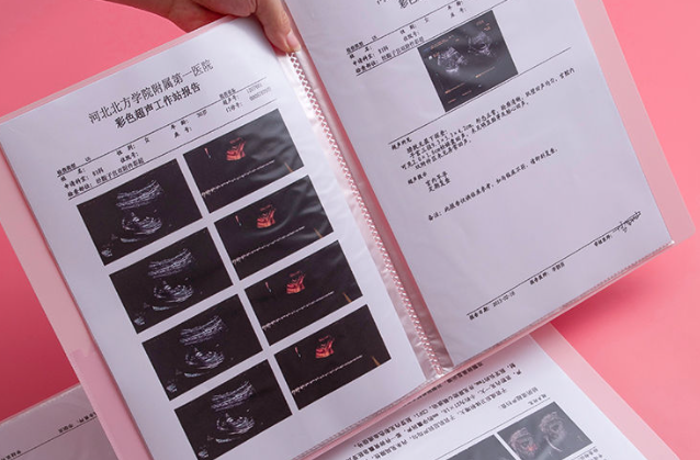 产检编号由数字或字母组成