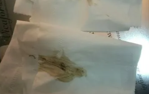 黄体期出血通常是少量的