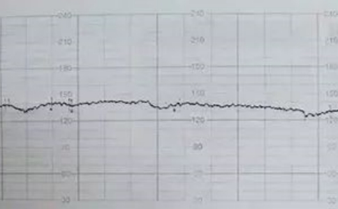 胎心监护是时段性的