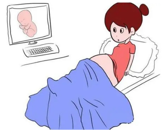 小排畸检查