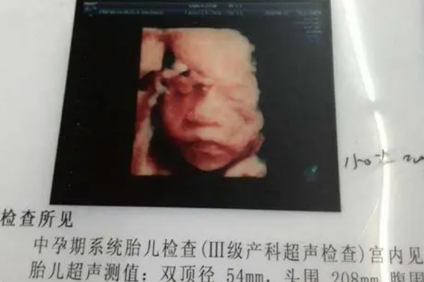 不随意发四维照片可保护隐私