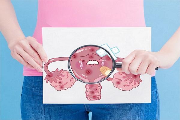 子宫内膜异位症分期与病变范围相关