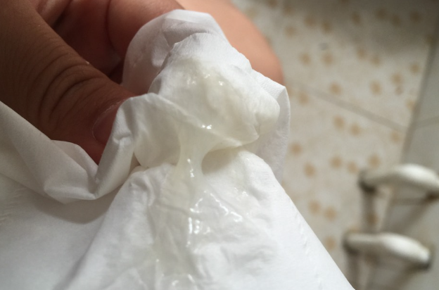 正常白带是乳白色