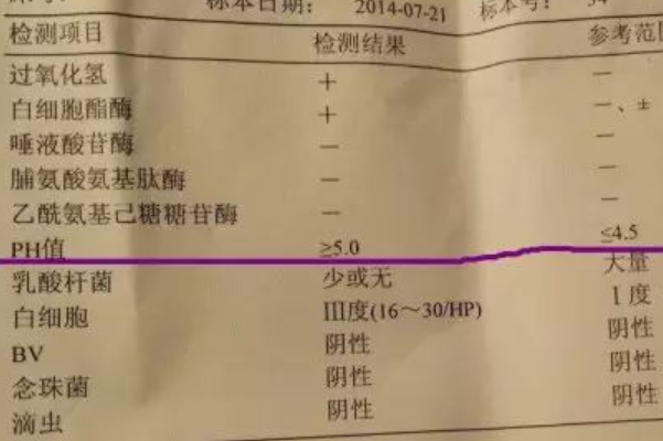 霉菌性阴道炎很容易复发
